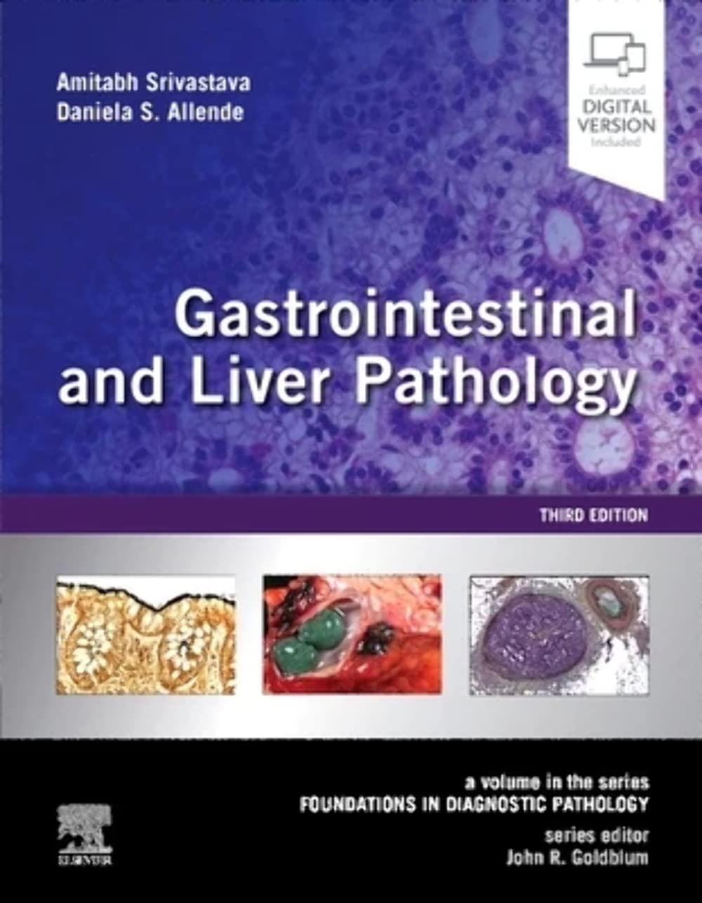 gastrointestinal-and-liver-pathology-a-volume-in-the-series-foundations-in-diagnostic-pathology
