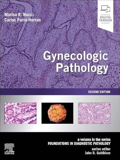 gynecologic-pathology-a-volume-in-foundations-in-diagnostic-pathology-series