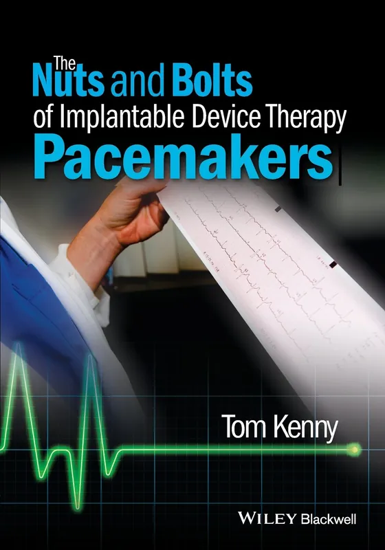 the-nuts-and-bolts-of-implantable-device-therapy-pacemakers-the-nuts-and-bolts-series-9781118670675-2702