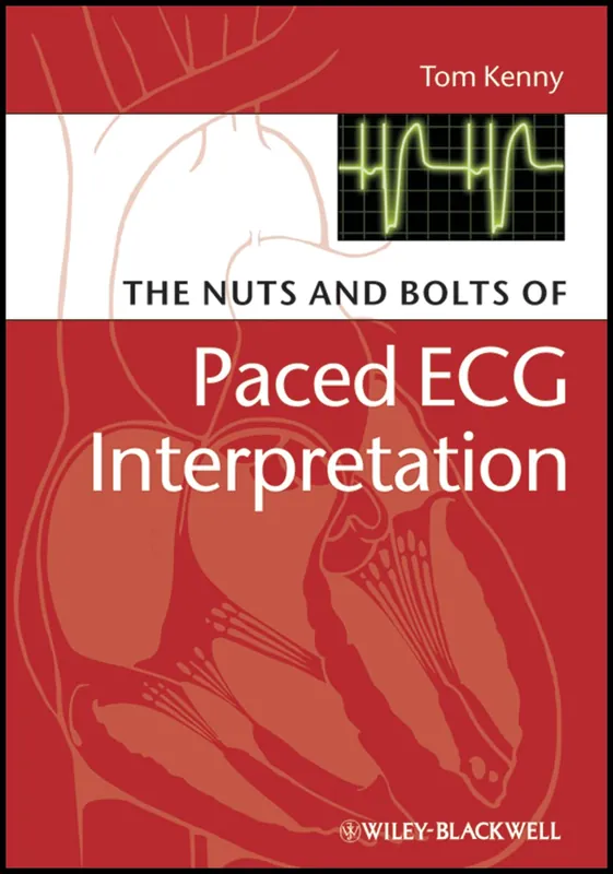 the-nuts-and-bolts-of-paced-ecg-interpretation-nuts-and-bolts-series-replaced-by-5113-9781405184045-2701